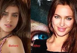Kuna nini Irina Shayk, kabla na baada ya plastiki? Na kama operesheni mara?