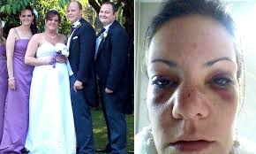 Bride's sister left with a broken nose during mass wedding brawl after  being knocked out by her uncle following buffet scramble for a piece of  chicken
