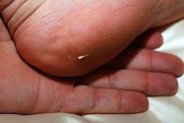 Pin On Helpful Diys