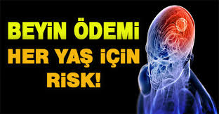 Beyin Odemi Belirtileri Ve Tedavisi Sarizeybekhaber