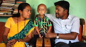Image result for progeria case in bihar