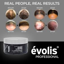 When applying deep hair conditioner treatments to the hair, be sure to get the mixture thoroughly mixed into every part of the hair. Buy Eacute Volis Reverse Mask Hair Mask For Hair Growth Deep Conditioning Hair Mask Hair Growth Treatment Hair Repair Mask Hair Mask For Color Treated Hair 8 5 Fl