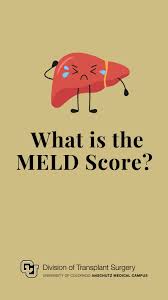 Image result for MELD Score