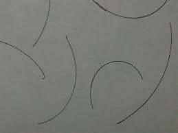 It is broken hairs, short and curly, with the white bulbs on ends.now look like boy.what is the problem? answered by dr. Hair Loss Forum Hair Transplant Shedding Hair With Black Bulb Or J Shaped Structure