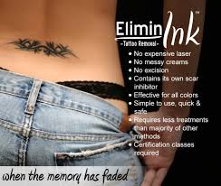 Laser tattoo removal in miami, florida request appointment. Tattoo Removal Miami Salvation Tattoo Lounge