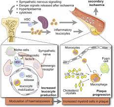 Atherosclerosis European Heart Journal Oxford Academic