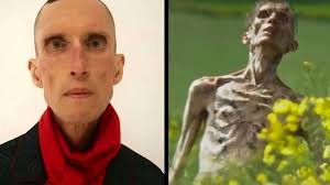 Cillian Murphy is not the infected in the 28 Years Later trailer  美術ディーラーのアンガス・ニールは、ゾンビを演じているのは彼だと言っている @guardian)