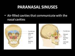 Paranasal Sinuses Anatomy Physiology And Diseases Ppt Video Online Download