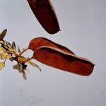 Image result for Brachystegia utilis