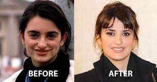 I do now own the rights.it is a repost of a creative commons youtube video. Chirurgie Markle Meghan Nachher Nasenjob Plastische Und Vorher Zahne Kosmetis Plastische Chirurgie Prominente Plastische Chirurgie Penelope Cruz