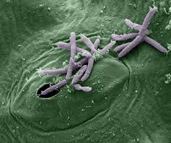 Image result for Pseudomonas syringae