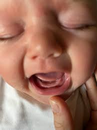 Baby teeth 🥹 She's 3 weeks old and this is what they look like! (Just  sharing because it's very cute, this girl has a home!)