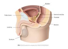 The risk of urinary retention (ur) following hypofractionated radiotherapy has yet to be fully elucidated. Benign Prostatic Enlargement Patient Information