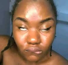 Home remedy for senior yorkie eye problems?