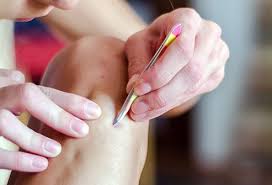 I do take tips and advice so thanks for your input and thank. How To Get Rid Of Ingrown Hair Removal Tips Remedies