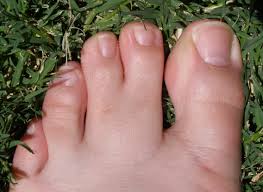 What does numbness in big toe mean? Webbed Toes Wikipedia