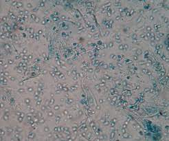 Thirty minutes after we got home i started crying. How Can The Presence Of Clue Cells Be Explained In Vaginosis