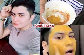 Kisar kering semua satu persatu. Abang Ini Kongsi Tips Mudah Cara Untuk Hilangkan Jerawat Dan Putihkan Kulit Dengan Kos Bawah Rm20 Kisah Dunia