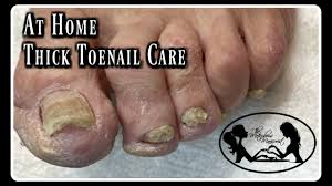 elderly toenails cutting thick toenails
