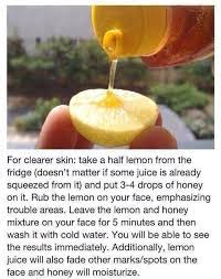 How To Get Clear And Spotless Skin 14 Natural Remedies And Tips Natural Acne Beauty Remedies Skin Remedies