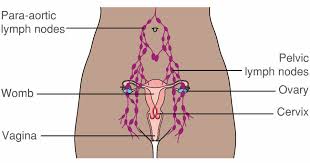 If there is communication, or a related inguinal hernia, a cut is made in the upper groin area. The Vulva Vulval Cancer And Lymph Nodes In The Groin Macmillan Cancer Support