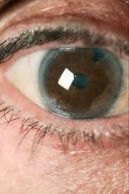 What Your Eyes Say About Your Health Why Do I Have Red Eyes