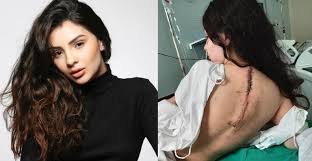 Mabel foi diagnosticada, em 2019, logo após dar à a jovem ficou conhecida por seus trabalhos na rede globo, nas novelas malhação e orgulho e paixão. Vdykf7wx2g6xfm