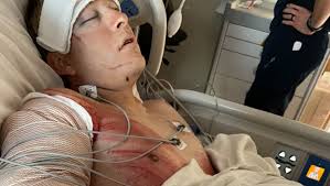 Fundraiser for Mckena Yarbrough by Shauna Clark : Help Chanse with his  recovery