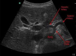Pin By Excalibur Healthcare Www Ex On Excalibur Healthcare S Imaging Teleradiology Pins Medical Ultrasound Ultrasound Technician Diagnostic Medical Sonography