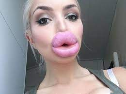 Enormous 'porn star lips' on show in terrifying gallery of selfies | The  Scottish Sun