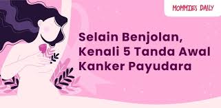 Li j., chen s., chen c., et al. Infografik Selain Benjolan Kenali 5 Tanda Awal Kanker Payudara Mommies Daily