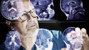 Image result for Posterior Circulation