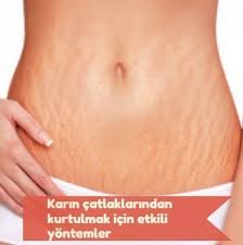 Effektive Methoden Um Dehnungsstreifen Im Bauchraum Loszuwerden Bauchraum Dehnungsstreifen Effektive Abdominal Stretches Health Lifestyle Stretch Marks