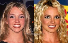 Pin On Celebrities Before After