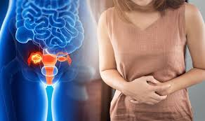 Symptoms of ovarian cancer may include bloating and weight gain, pain during intercourse, or a change in bowel habits. Ovarian Cancer Symptoms If You Have Bloating And Other Signs Take This Test Express Co Uk