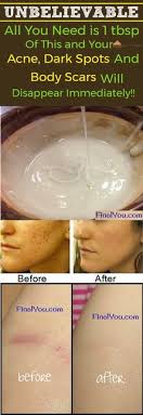 Syretta Henderson (rettaplus2)