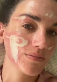 Dr Rosenberg Beverly Hills