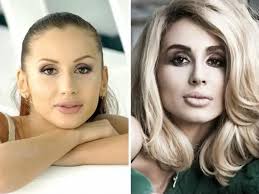 Дина саева на шоу карины кросс и артура бабича. Kak Menyalas Svetlana Loboda Foto Do Plastiki I Posle Pravdivy Sekrety Stilya Mediaplatforma Mirtesen