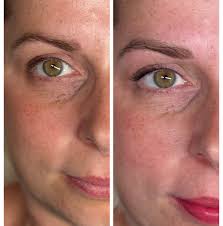 Julia Starke Permanent Make up & Klangschale (@laluna_beautx_pmu) · Berlin