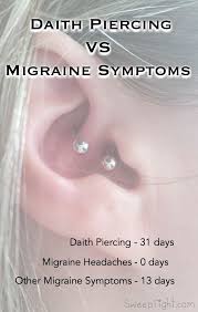 The Ear Piercing For Migraines Results After 31 Days Ear Piercing For Migraines Migraine Piercing Migraine Headaches