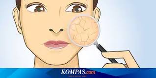 Maybe you would like to learn more about one of these? Cuaca Panas Bikin Kulit Kering Ini Yang Harus Anda Lakukan Halaman All Kompas Com