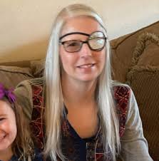 What to do for a turkey with a leg injury after hatching?