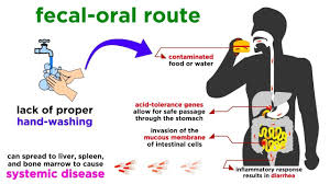 Image result for Typhoid Fever