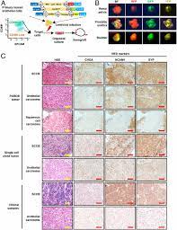 The most widely accepted ribbon by various bladder cancer organizations is the color orange. A Genetically Defined Disease Model Reveals That Urothelial Cells Can Initiate Divergent Bladder Cancer Phenotypes Pnas