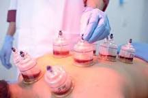 Hasil gambar untuk bekam panggilan Cianjur