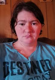 Hey everyone! I was wondering if anyone has been able to make monster  dentures without acrylic power and monomer? I'm deadly allergic and  unfortunately found that out making my first pair. I