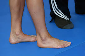 Photographer Anticipates Our Desire to See Kate Middletons Bare Feet