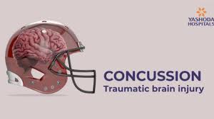 If you suffer concussion after a blow to your head, you lose consciousness or feel sick. Concussion Symptoms Causes Diagnosis And Treatments