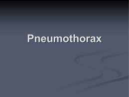 Maybe you would like to learn more about one of these? Pneumothorax