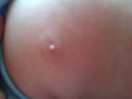 Chicas Ayuda Pezon Del Bb Blanco 0 Bebes De Enero 2014 Babycenter